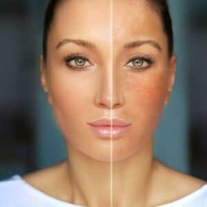 kosmetologiczne zabiegi na skórę